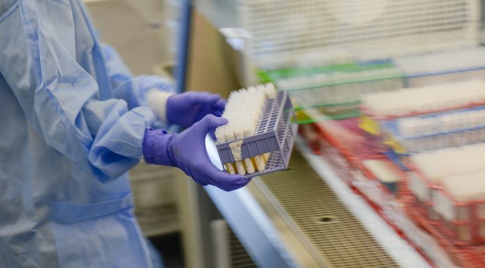 India’s FELUDA Rapid Low-cost Strip Test Is A Potential Game Changer In The Anti-Pandemic Fight